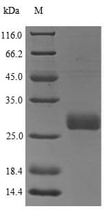 Rat OSM / Oncostatin M Protein (Recombinant 6His, N-terminus)