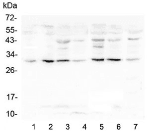 RPS3 / Ribosomal Protein S3 Antibody