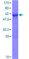 Human PMM1 Protein (Recombinant GST)