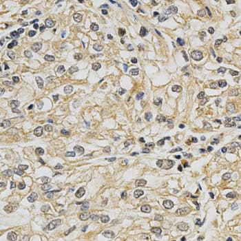 Polyclonal Rabbit anti-Human CYP19 / Aromatase Antibody (IHC, WB)