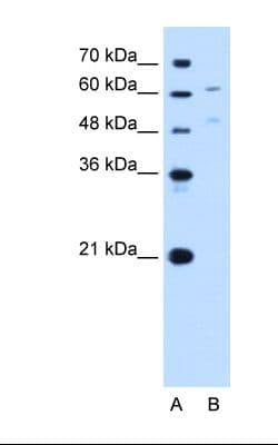 UGT1A4 Antibody (aa59-108)