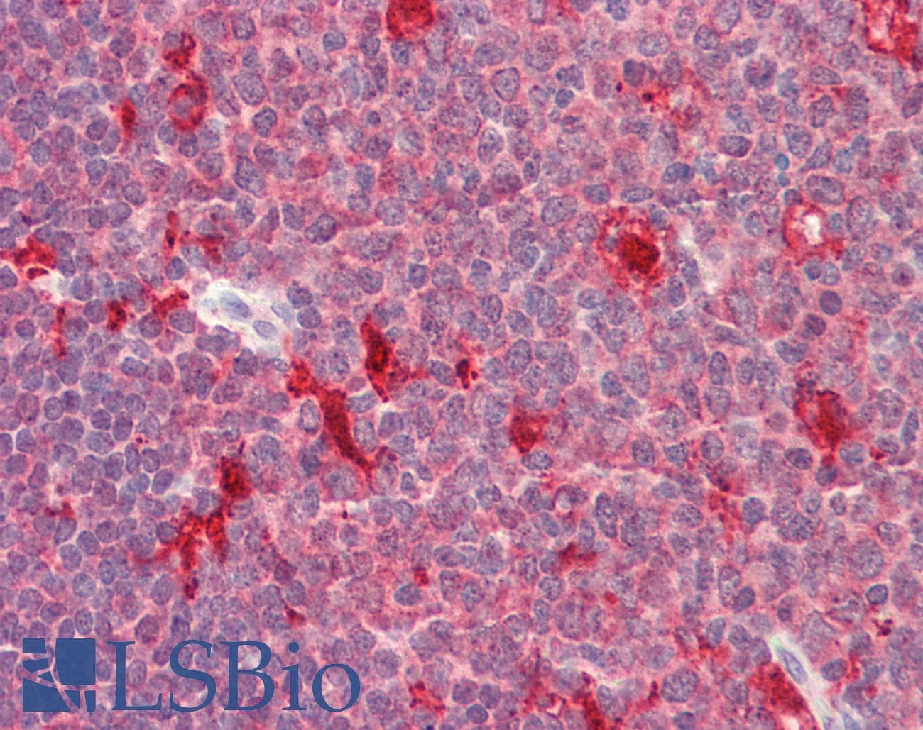 IHC-plus™ PDXP / Pyridoxal Phosphatase Antibody (aa275-286)