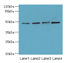 TTC5 Antibody (aa201-440)
