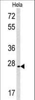 CREM / ICER Antibody (aa287-314)