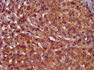 Polyclonal Rabbit anti-Human HPS6 Antibody (IHC, IF)