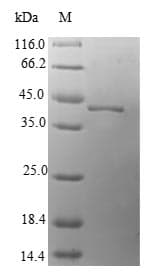 Human LAMTOR3 / MP1 Protein (Recombinant GST, N-terminus)