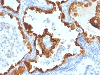 Cytokeratin 8+18 Antibody (clone C-43 + DC10)