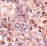 Polyclonal Rabbit anti-Human ABCB7 Antibody (aa718-746, IHC, WB)