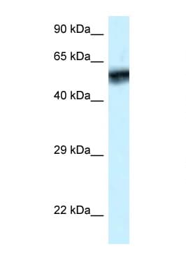 CAMK4 / CaMK IV Antibody (aa53-102)