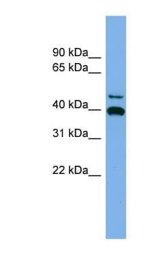 FGL2 Antibody (aa251-300)