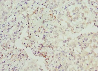 Polyclonal Rabbit anti-Human BAAT / BAT Antibody (IHC, WB)