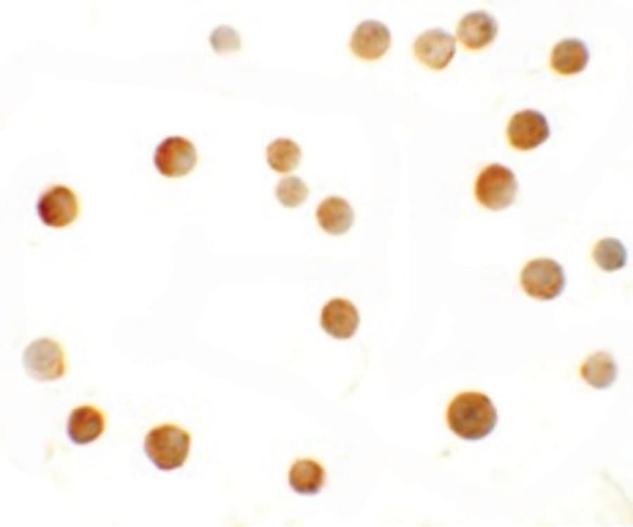 IHC-plus™ ZMYM2 / RAMP Antibody