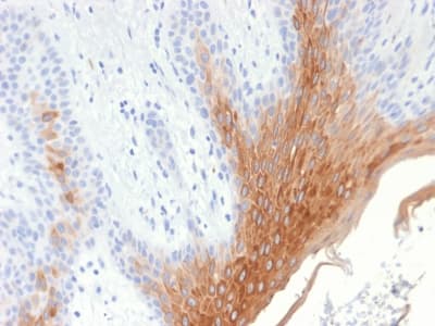 KRT10 / CK10 / Cytokeratin 10 Antibody (clone KRT10/1990R, Azide-free, Carrier-free)