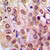 Polyclonal Rabbit anti-Human AKT1 + AKT2 + AKT3 Antibody (Internal, IHC, WB)