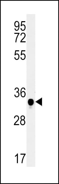 C19orf39 Antibody (aa84-110)