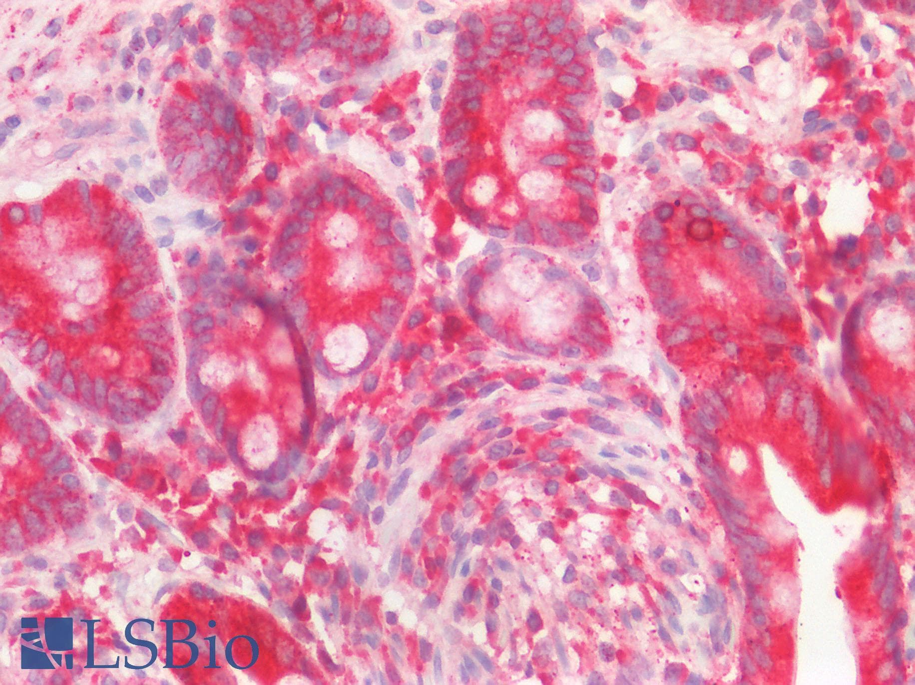 IHC-plus™ IFIH1 / MDA5 Antibody