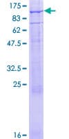 Human CNGA3 Protein (Recombinant GST)