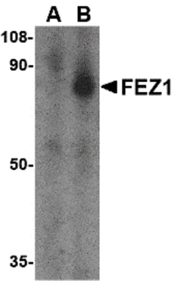 Polyclonal Rabbit anti-Human FEZ1 Antibody (WB)