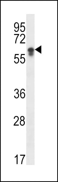 Polyclonal Rabbit anti-Human CYP2S1 Antibody (aa399-428, IHC, IF, WB)