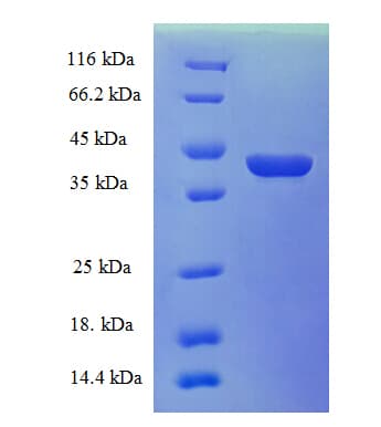 Human CRABP1 / CRABP Protein (Recombinant GST)