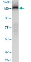Monoclonal Mouse anti-Human TRIM33 / TIF1-Gamma Antibody (clone 6D1, IHC, IF, WB)