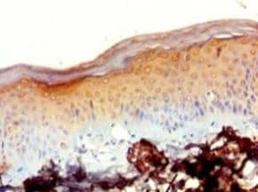 MRPL20 Antibody (aa46-149, HRP)