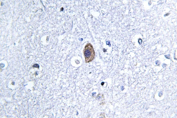 CNN2 Antibody (Asp156)