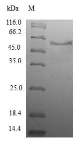 Human WDR38 Protein (Recombinant GST, N-terminus)