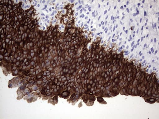 Monoclonal Mouse anti-Human KRT19 / CK19 / Cytokeratin 19 Antibody (clone OTI5H6, aa240-390, IHC, WB)