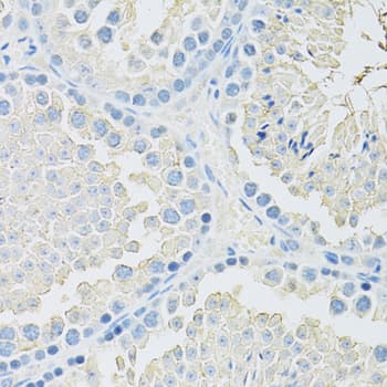 SLC2A9 / GLUT9 Antibody