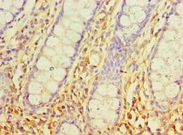 SRM / Spermidine Synthase Antibody (aa1-302)