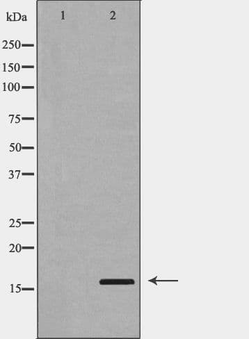 PLA2G2A / SPLA2 Antibody