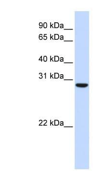 Polyclonal Rabbit anti-Human TPGS2 / C18orf10 Antibody (aa180-229, WB)