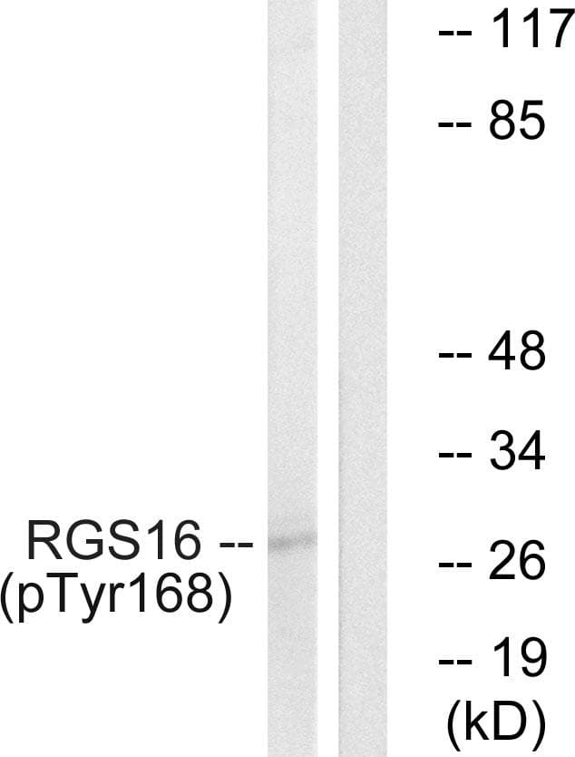 RGS16 Antibody (phospho-Tyr168)