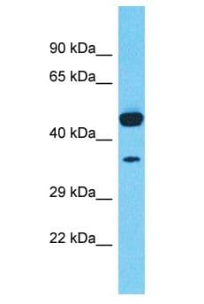 Polyclonal Rabbit anti-Human TMEM168 Antibody (aa81-130, WB)