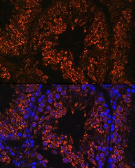 Polyclonal Rabbit anti-Human FER1L5 Antibody (IF)