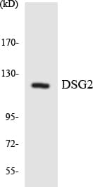 DSG2 / Desmoglein 2 Antibody (aa391-440)