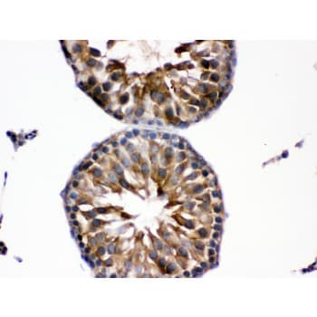 EDNRB / Endothelin B Receptor Antibody (aa406-439)