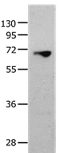 MMP25 / Leukolysin Antibody