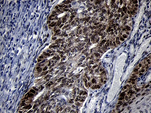 TCF12 / HEB Antibody (clone OTI2E11)