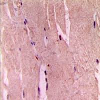 GYS1 / Glycogen Synthase Antibody (C-Terminus)
