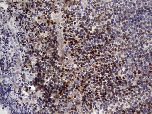 IKZF3 / AIOLOS Antibody (aa1-301, clone OTI7E11, Carrier-free)