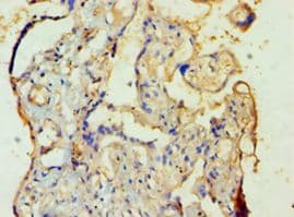 Polyclonal Rabbit anti-Human M-PST / STM Antibody (aa1-295, IHC, WB)
