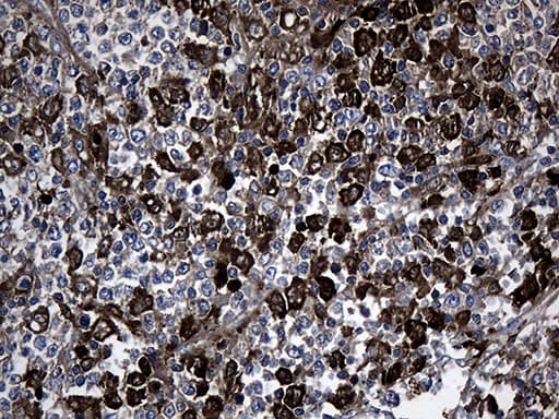 Monoclonal Mouse anti-Human GTPCH1 / GCH1 Antibody (clone OTI3A3, IHC, WB)