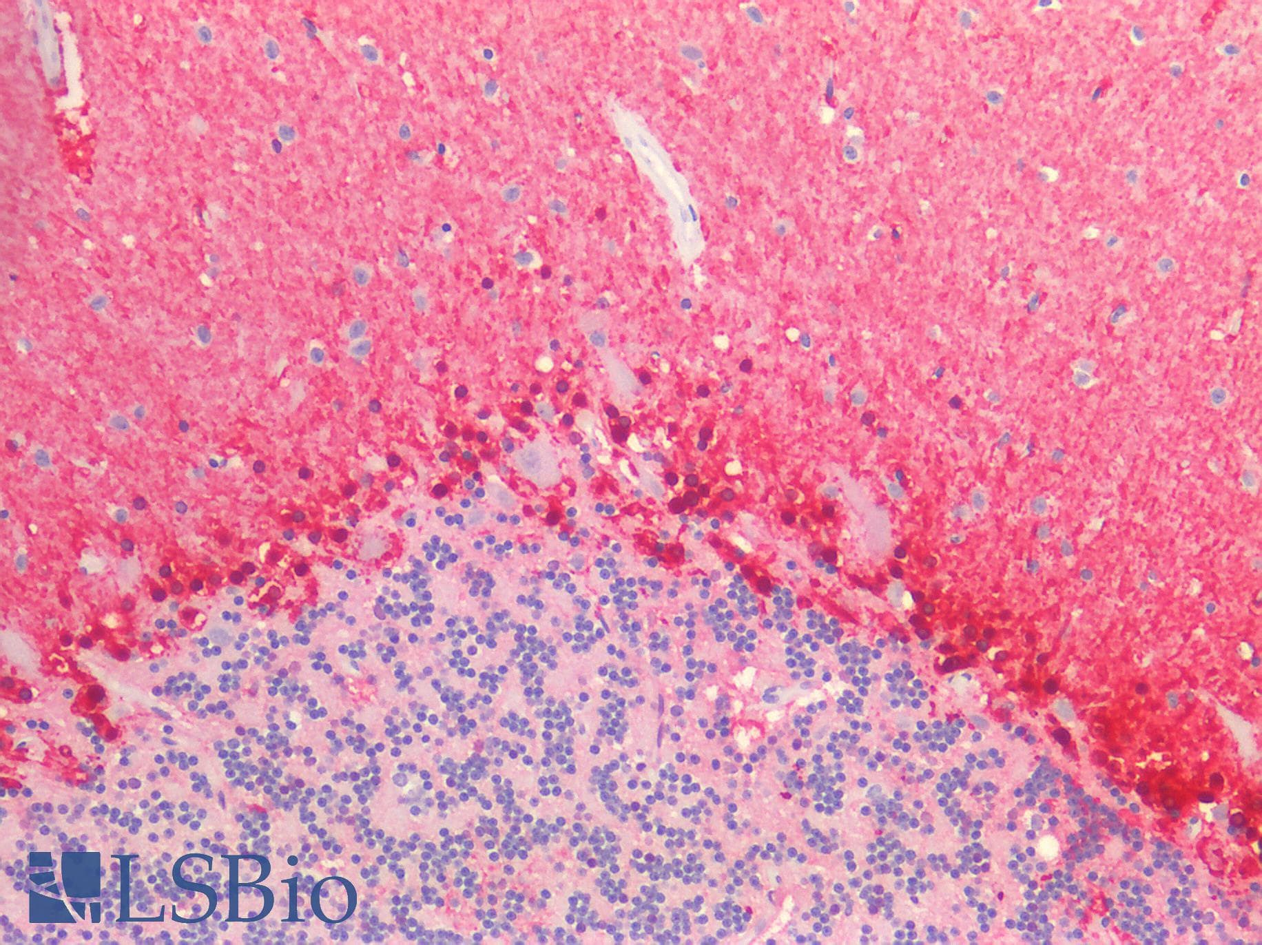 PathPlus™ ALDH1A1 / ALDH1 Antibody (clone 1G6)