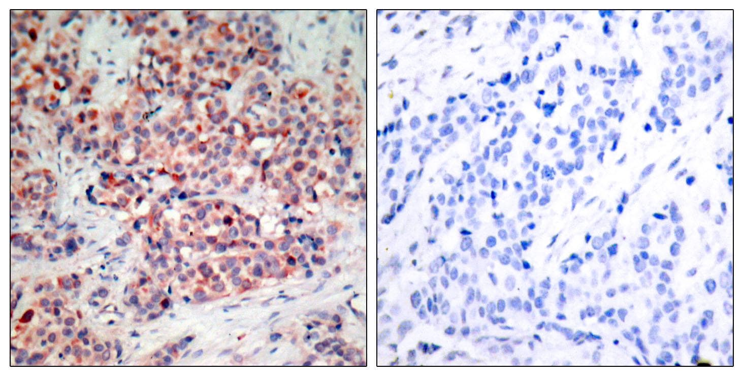 Polyclonal Rabbit anti-Human PTEN Antibody (p370, IHC, WB)