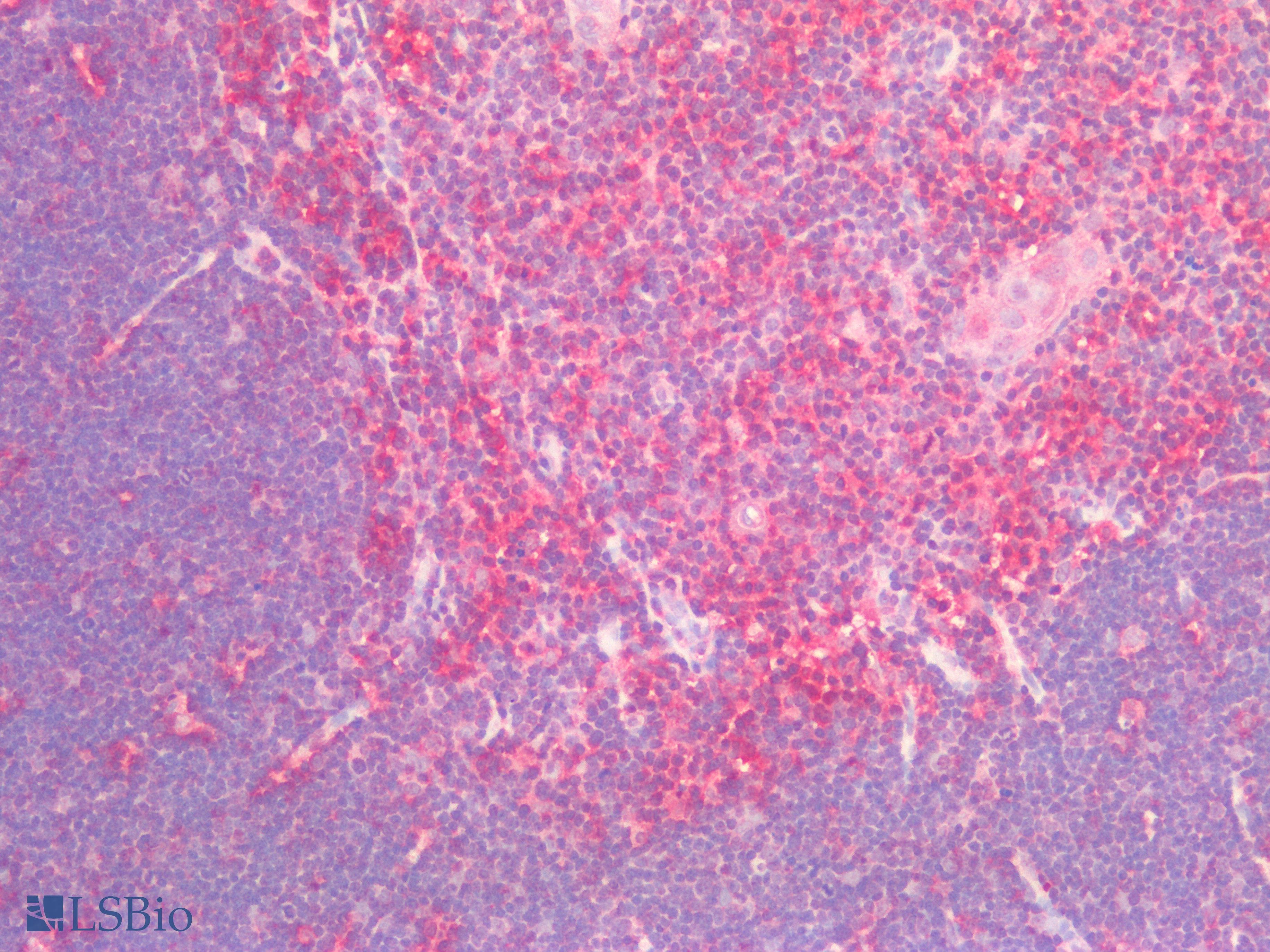 PathPlus™ PD-L2 / PDCD1LG2 / CD273 Antibody