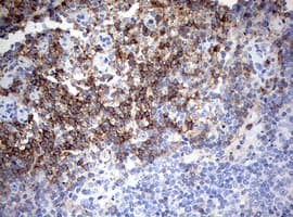 Monoclonal Mouse anti-Human CD4 Antibody (clone OTI5C2, IHC, WB)