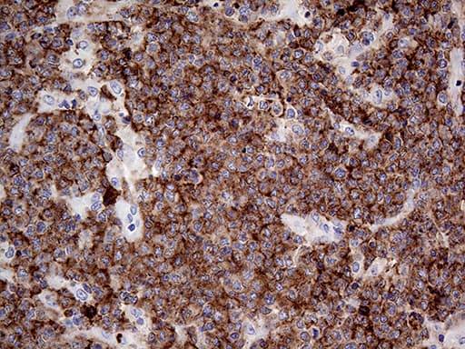 CD79B / CD79 Beta Antibody (clone OTI9G1, Carrier-free)