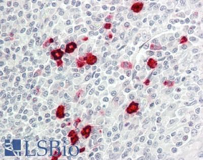 IHC-plus™ HMOX1 / HO-1 Antibody (clone 5C6)